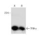 TFIIA-γ Antibody (D-6) - Western Blotting - Image 151046