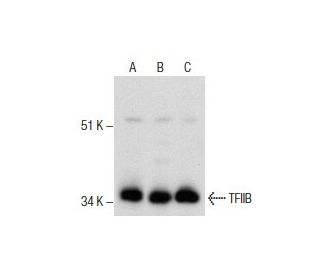 TFIIB Antibody (24) - Western Blotting - Image 285982 
