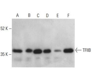 TFIIB Antibody (IIB8) - Western Blotting - Image 399142 