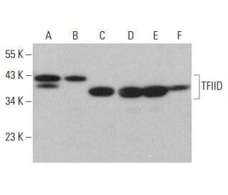 TFIID/TATA Binding Protein/TBP Antibody (1TB18) - Western Blotting - Image 380427 