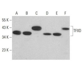 TFIID/TATA Binding Protein/TBP Antibody (1TBP18) - Western Blotting - Image 380428 