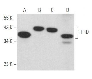 TFIID/TATA Binding Protein/TBP Antibody (ITBP20) - Western Blotting - Image 357432 
