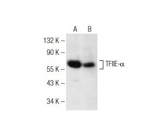 TFIIE-&alpha; Antibody (B-7) - Western Blotting - Image 147367 