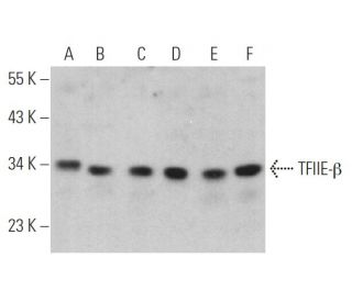 TFIIE-&beta; Antibody (A-1) - Western Blotting - Image 374502 