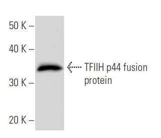 TFIIH p44 Antibody (GTF2F6A10) - Western Blotting - Image 16807