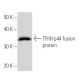 TFIIH p44 Antibody (GTF2F6A10) - Western Blotting - Image 16807
