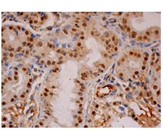 TFIIH p52 Antibody (A-2) - Immunohistochemistry - Image 284869 