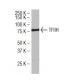 TFIIH p80 Antibody (184.7) - Western Blotting - Image 34536 