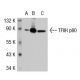 TFIIH p80 Antibody (184.7) - Western Blotting - Image 38756 
