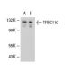 TFIIIC110 Antibody (2395C2a) - Western Blotting - Image 20442