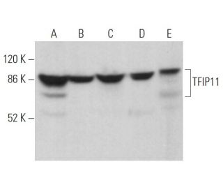 TFIP11 Antibody (D-4) - Western Blotting - Image 374426 
