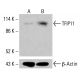 TFIP11 Antibody (D-4) - Western Blotting - Image 415128