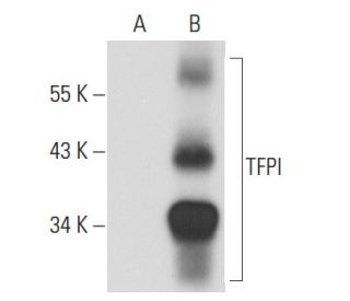 TFPI Antibody (G-1) - Western Blotting - Image 58205