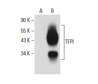 TFPI Antibody (G-6) - Western Blotting - Image 44234 