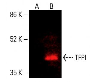 TFPI Antibody (G-5) - Western Blotting - Image 416248Each CRISPR/Cas9 Knockout (KO) Plasmid product consists of a pool of 3 plasmids designed to ensure identification and cleavage of a specific gene for maximum knockout efficiency. Each plasmid encodes a unique 20 nt sequence derived from the GeCKO (v2) library.