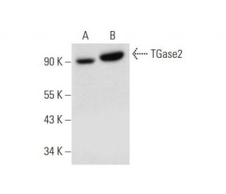 TGase2 Antibody (G-8) - Western Blotting - Image 333415 