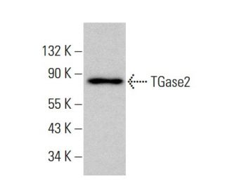 TGase2 Antibody (4G3) - Western Blotting - Image 384689Each CRISPR/Cas9 Knockout (KO) Plasmid product consists of a pool of 3 plasmids designed to ensure identification and cleavage of a specific gene for maximum knockout efficiency. Each plasmid encodes a unique 20 nt sequence derived from the GeCKO (v2) library.