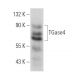 TGase4 Antibody (C-11) - Western Blotting - Image 366670