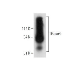 TGase4 Antibody (E-9) - Western Blotting - Image 332795