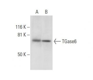TGase6 Antibody (E-1) - Western Blotting - Image 301453SAM Transcription Activation: SAM system utilizing dCas9-VP64, MS2-P65-HSF1, and sgRNA for precise gene transcription activation.