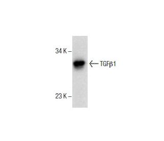 TGF beta 1 Antibody (2E6) - Western Blotting - Image 285912The Double Nickase Plasmid features a U6 promoter for sgRNA expression, a 20 nt targeting sequence, and a gRNA scaffold to guide Cas9n. It includes a CBh promoter for Cas9n (D10A) and puromycin resistance, GFP for transfection verification, and nuclear localization signals (NLS). The 2A peptide allows co-expression of Cas9n and Puro from a single promoter, enabling precise genome editing with reduced off-target effects. 