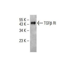 TGF beta Receptor 1/TGFBR1 Antibody (C-12) - Western Blotting - Image 394770SAM Transcription Activation: SAM system utilizing dCas9-VP64, MS2-P65-HSF1, and sgRNA for precise gene transcription activation.