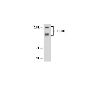 TGF beta Receptor 3/TGFBR3 Antibody (A-4) - Western Blotting - Image 17309