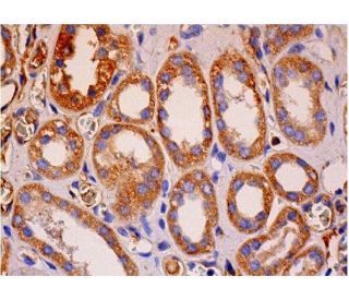 TGF&alpha; Antibody (D-6) - Immunohistochemistry - Image 286452 