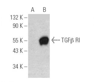 TGF beta Receptor 1/TGFBR1 Antibody (B-7) - Western Blotting - Image 389909