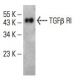 TGF beta Receptor 1/TGFBR1 Antibody (C-12) - Western Blotting - Image 394770