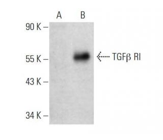 TGF beta Receptor 1/TGFBR1 Antibody (D-1) - Western Blotting - Image 385935
