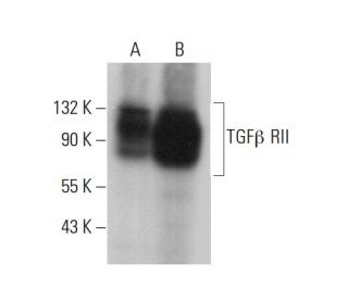 TGF beta Receptor 2/TGFBR2 Antibody (D-2) - Western Blotting - Image 376372 