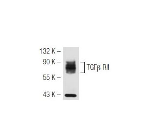 TGF beta Receptor 2/TGFBR2 Antibody (E-6) - Western Blotting - Image 47096 