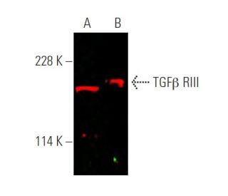 TGF beta Receptor 3/TGFBR3 Antibody (A-4) - Western Blotting - Image 375702 