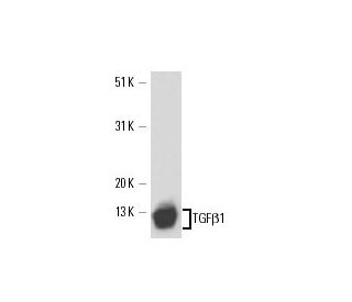 TGF beta 1 Antibody (2E6) - Western Blotting - Image 17227 