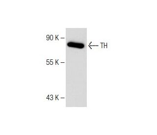 Tyrosine Hydrolase Antibody (A-6) - Western Blotting - Image 147899