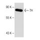 Tyrosine Hydrolase Antibody (A-6) - Western Blotting - Image 147899