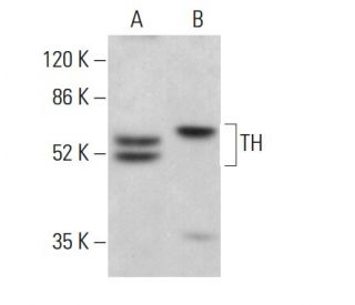 Tyrosine Hydrolase Antibody (TOH A1.1) - Western Blotting - Image 380643 