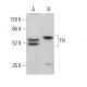 Tyrosine Hydrolase Antibody (TOH A1.1) - Western Blotting - Image 380643 