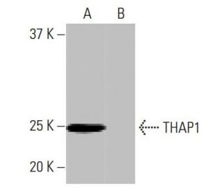THAP1 Antibody (3H3) - Western Blotting - Image 65071SAM Transcription Activation: SAM system utilizing dCas9-VP64, MS2-P65-HSF1, and sgRNA for precise gene transcription activation. 