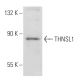 THNSL1 Antibody (77-Y) - Western Blotting - Image 48675 