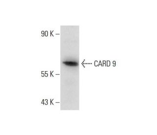 THP-1 Cell Lysate: sc-2238. Western blot analysis of CARD 9... 