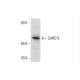 THP-1 Cell Lysate: sc-2238. Western blot analysis of CARD 9... 