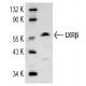 LXRβ (Y-16): sc-34341. Western blot analysis of LXRβ expression in THP-1 nuclear extract.