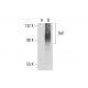 THP (B-2): sc-271022. Western blot analysis of THP expression in... 