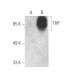 THP (B-2) HRP: sc-271022 HRP. Direct western blot analysis of...