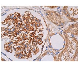 Thrombin R Antibody (ATAP2) - Immunohistochemistry - Image 361363 