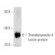 Thrombospondin 4 Antibody (G-10) - Western Blotting - Image 6456 