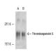 Thrombospondin 5 Antibody (644A8D5) - Western Blotting - Image 11054