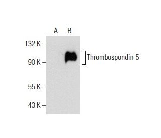 Thrombospondin 5 Antibody (F-7) - Western Blotting - Image 155159Each CRISPR/Cas9 Knockout (KO) Plasmid product consists of a pool of 3 plasmids designed to ensure identification and cleavage of a specific gene for maximum knockout efficiency. Each plasmid encodes a unique 20 nt sequence derived from the GeCKO (v2) library.